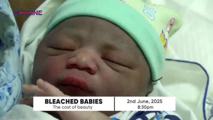Bleached Babies: The toxic beauty obsession endangering Ghana’s children - Nsemkeka